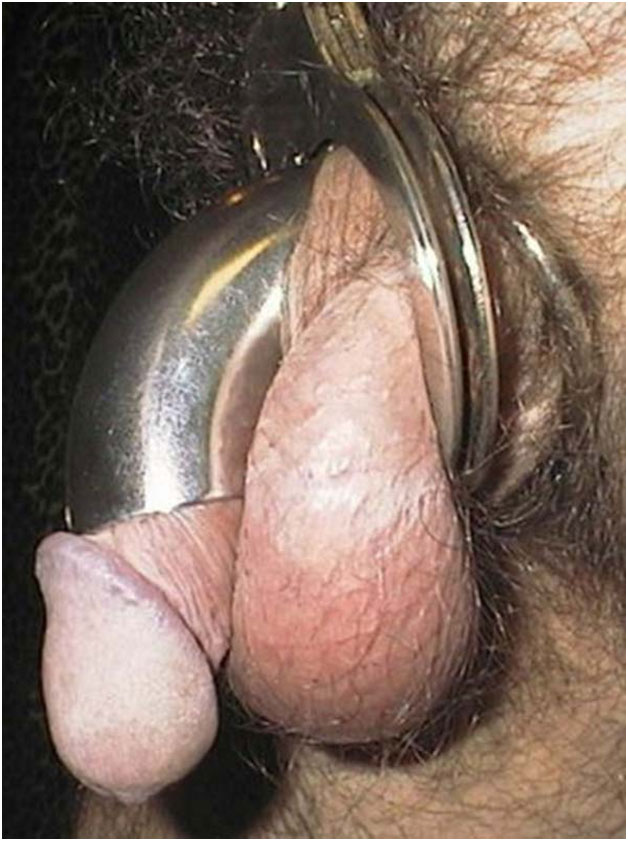  Chastity Devices Image